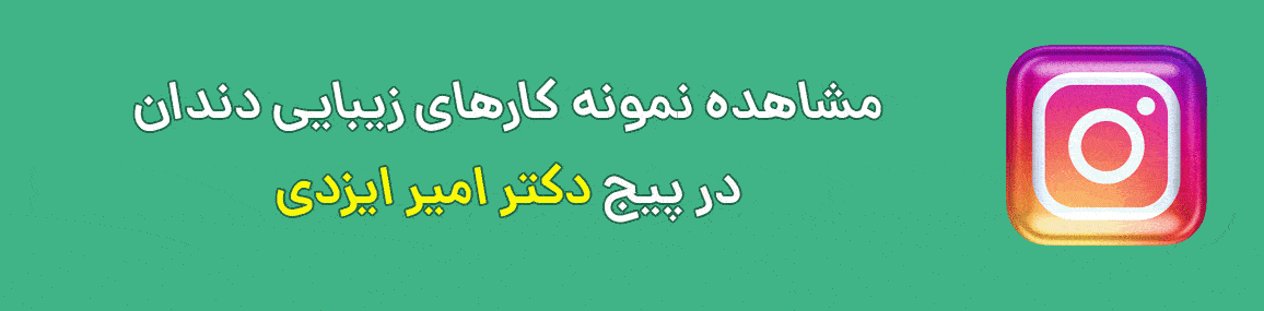 بنر اینستاگرام