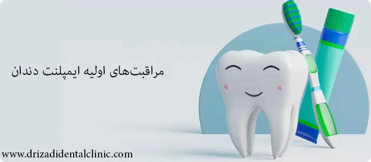 نگهداری از ایمپلنت دندان