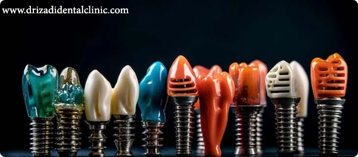 سن مناسب برای ایمپلنت دندان