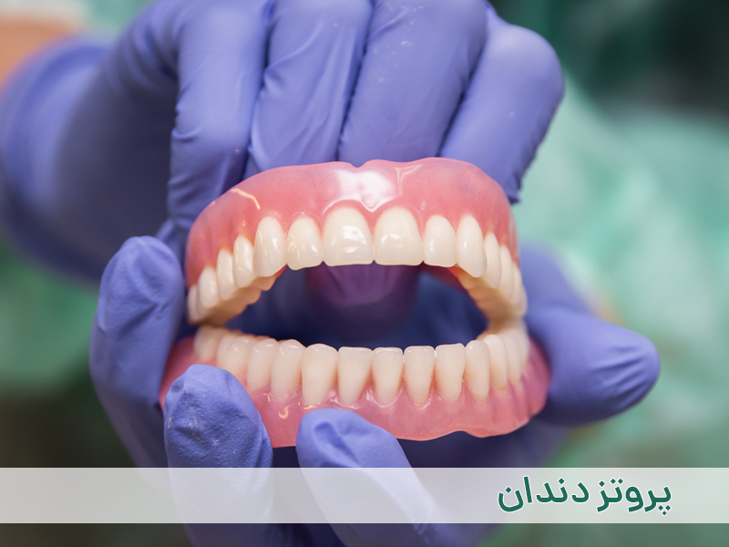 پروتز دندان