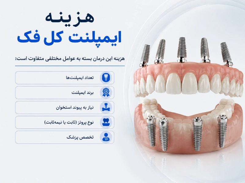هزینه ایمپلنت کل فک