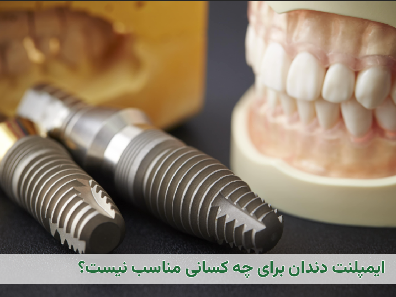 کاشت ایمپلنت نا موفق