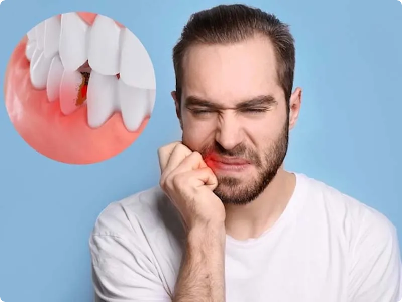 علائم پس زدن ایمپلنت
