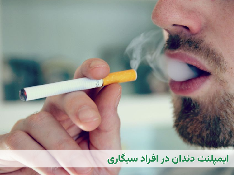 ایمپلنت در افراد سیگاری