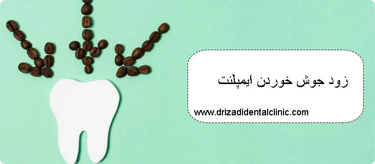 جوش خوردن ایمپلنت