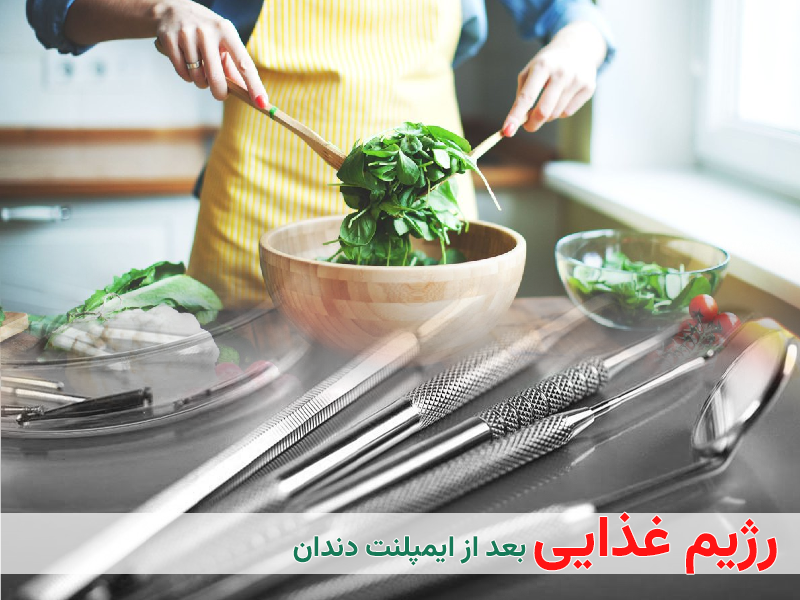 رژیم غذایی بعد از ایمپلنت دندان