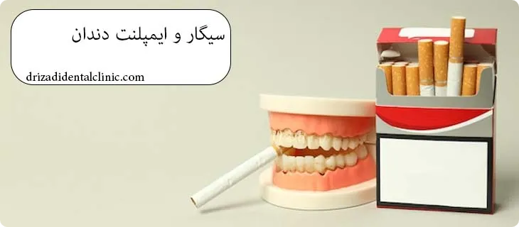 سیگار بعد از ایمپلنت دندان