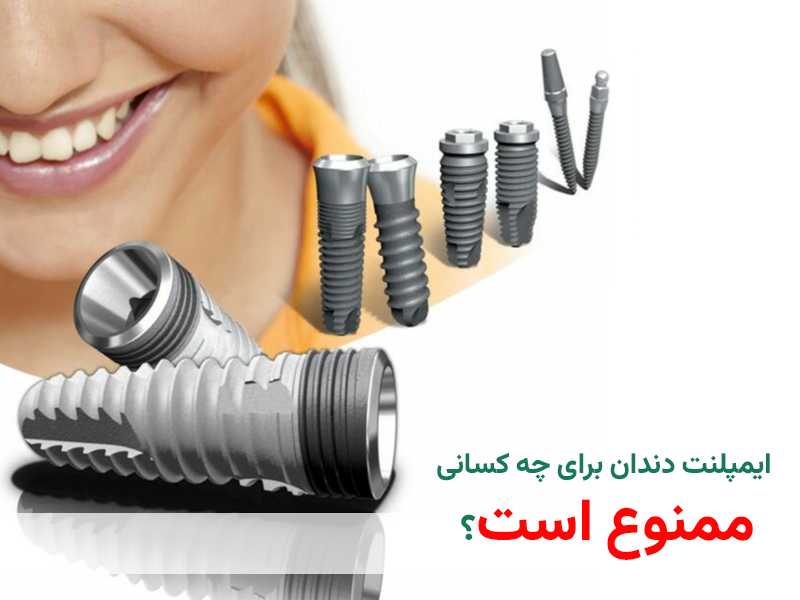 ممنوعیت های ایمپلنت دندان