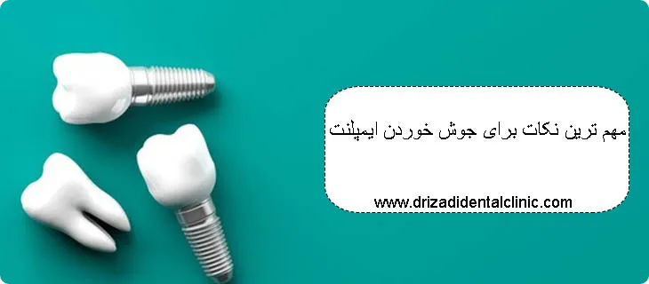 نکات جوش خوردن ایمپلنت