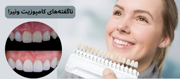 ناگفته‌های کامپوزیت ونیر!