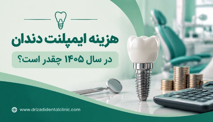 هزینه ایمپلنت دندان در سال ۱۴۰۵ و بررسی عوامل موثر بر قیمت کاشت دندان