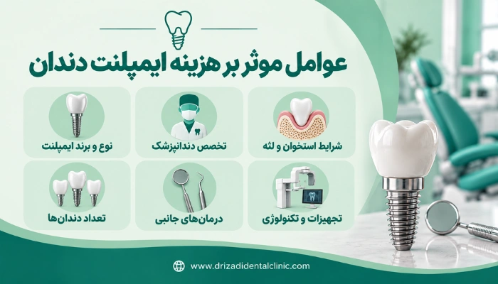 عوامل موثر بر هزینه ایمپلنت دندان شامل برند ایمپلنت، تخصص پزشک، شرایط استخوان و تعداد دندانها