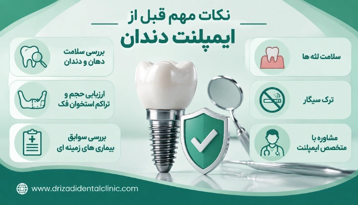 نکات مهم قبل از انجام لمینت دندان و آمادهسازی دندانها برای درمان زیبایی