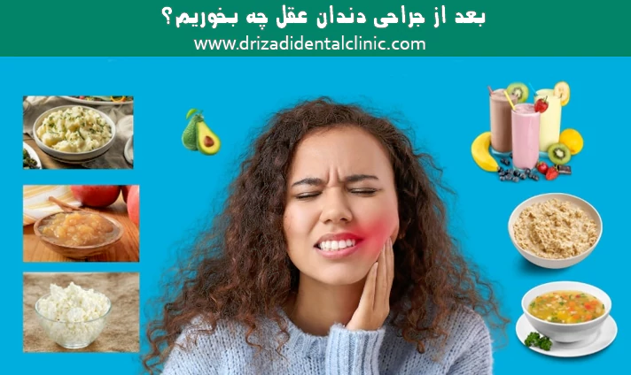 بعد از جراحی دندان عقل چه بخوریم؟