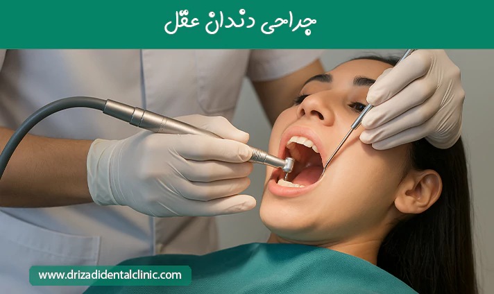 جراحی دندان عقل چیست؟