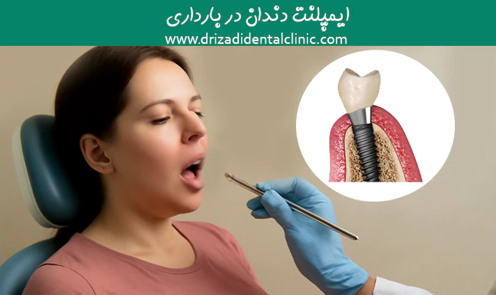ایمپلنت دندان در بارداری