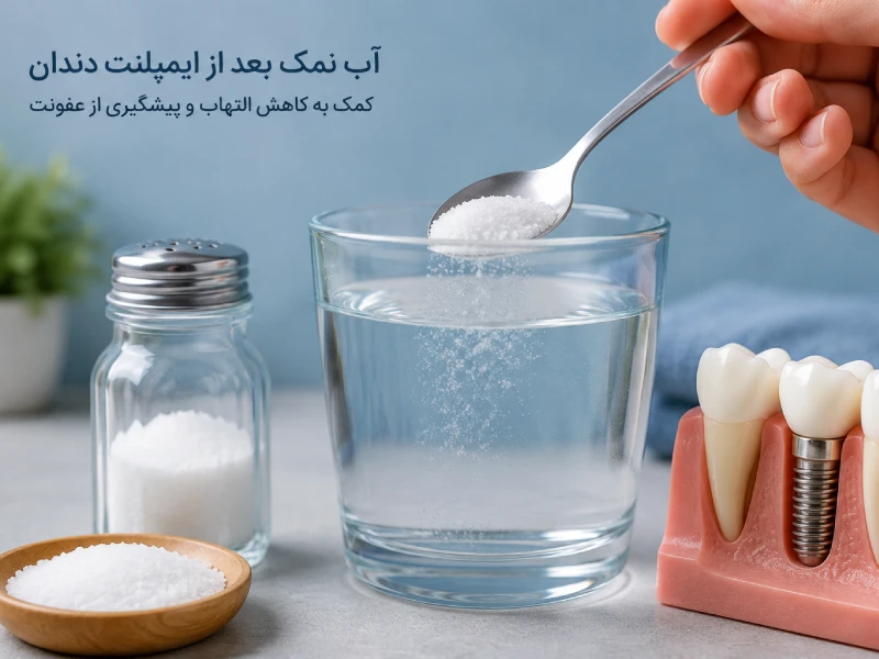 آب نمک بعد از ایمپلنت دندان