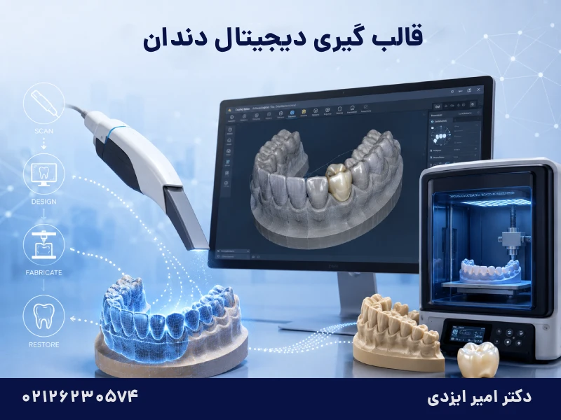 قالب گیری دیجیتال